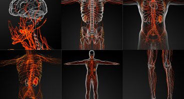 Limfinės sistemos sutrikimai: nuo patinusių kojų vakarais iki onkologinių susirgimų